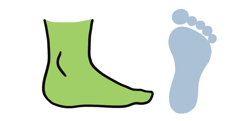 Low arch