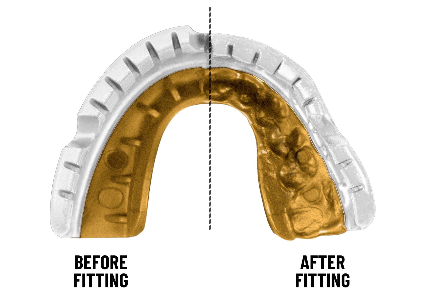 Opro Gold Braces Mouthguard, Unisex