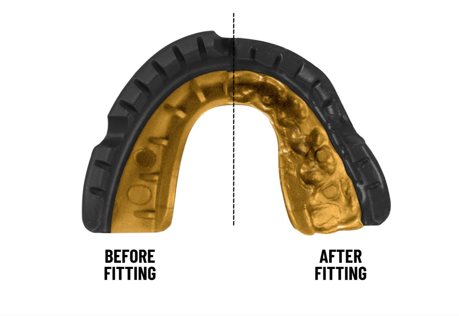 Opro Gold Braces Mouthguard, Unisex