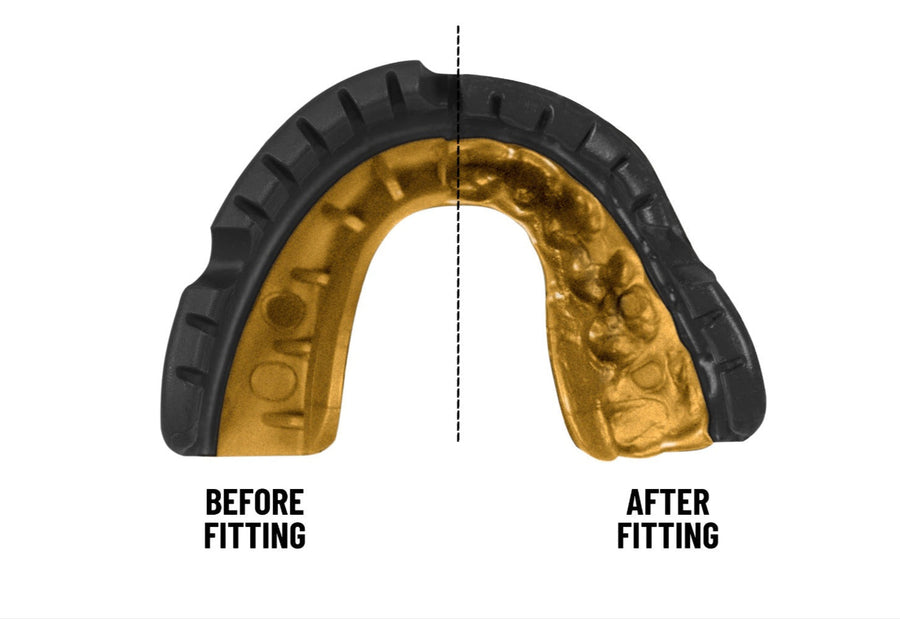 Opro Gold Braces Mouthguard, Unisex