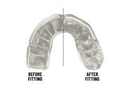 Opro Gen 5 Gold Mouthguard, Unisex