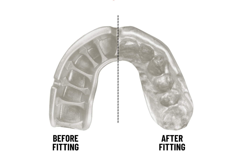 Opro Gen 5 Gold Mouthguard, Unisex